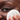 Glossier Solution - view 2